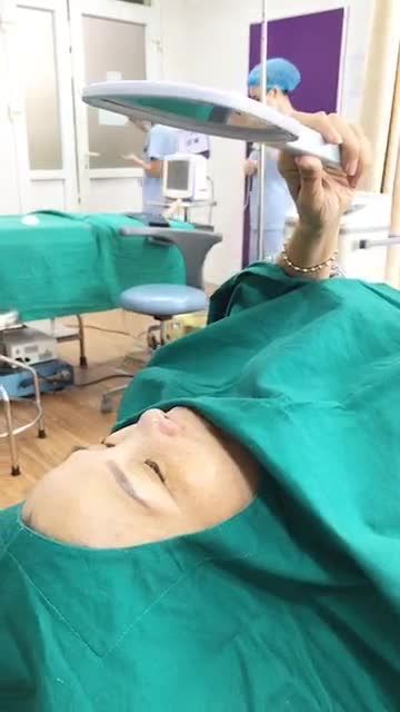 U50 vẫn nâng mũi được thoải mái, vừa đẹp lại không đau chút nào!
