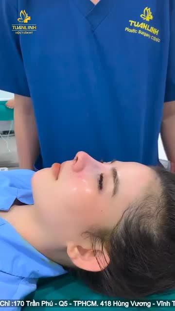 Case nâng mũi cấu trúc nha mọi người.