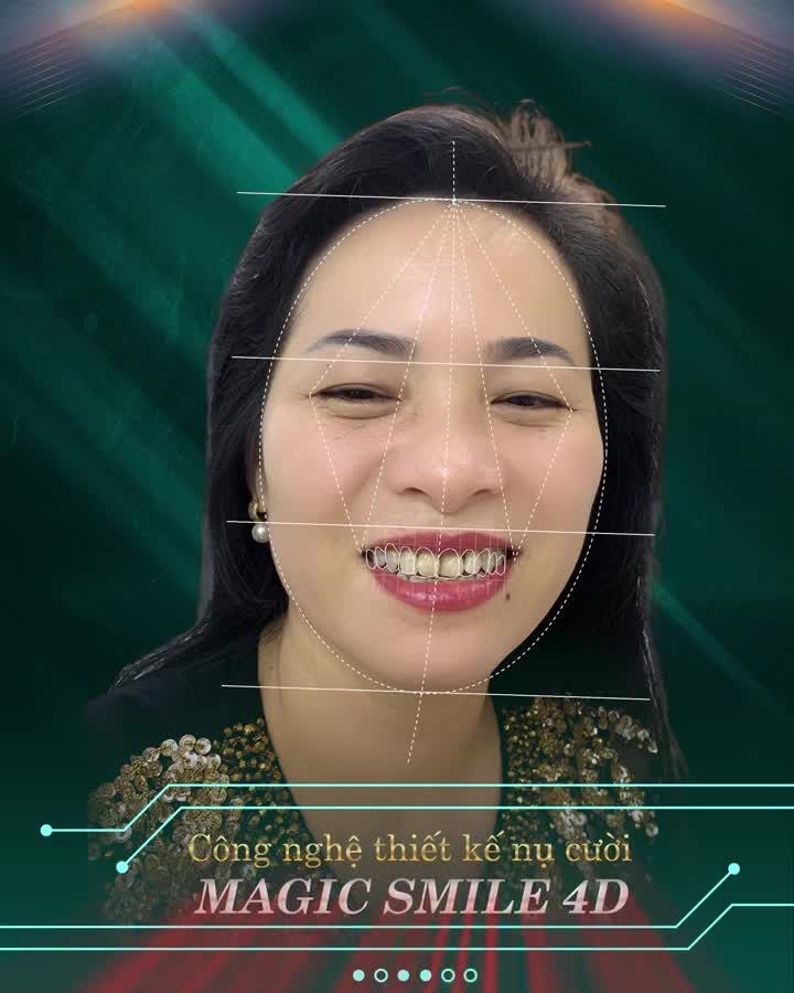 NGẮM ĐÔNG, NGẮM TÂY KHÔNG BẰNG NGẮM NỤ CƯỜI NHA KHOA GIA ĐÌNH 1 GIÂY