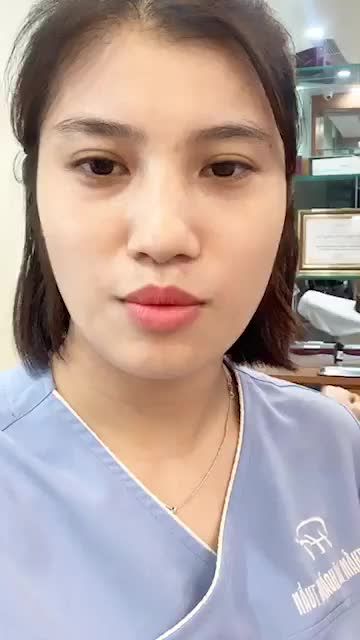Sẹo lồi - gây mất thẩm mỹ ! Mời cả nhà cùng theo dõi cận cảnh 1b điều trị Tại DR Hoàng Tuấn ạ.