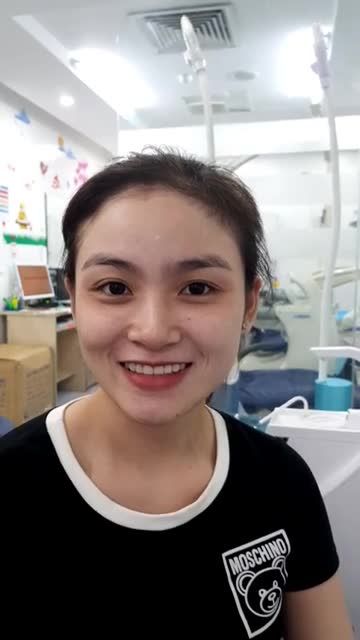 Hè này siêu ƯU ĐÃI - Có Răng Trắng Cười Sang sau 30 PHÚT