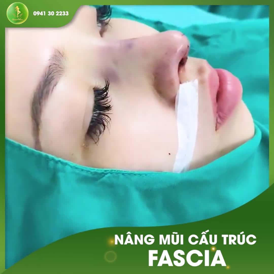 FORM MŨI CAO TÂY VỪA NÂNG ĐẸP MÊ LY