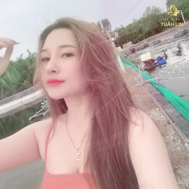 Mũi xấu làm bạn kém xinh, mất tự tin trong giao tiếp