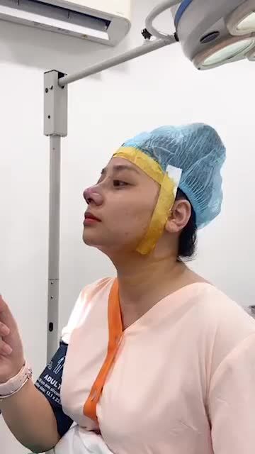 SAU PHẪU THUẬT 90P NHẸ NHÀNG - MŨI TO HÓA THON GỌN, THANH TÚ