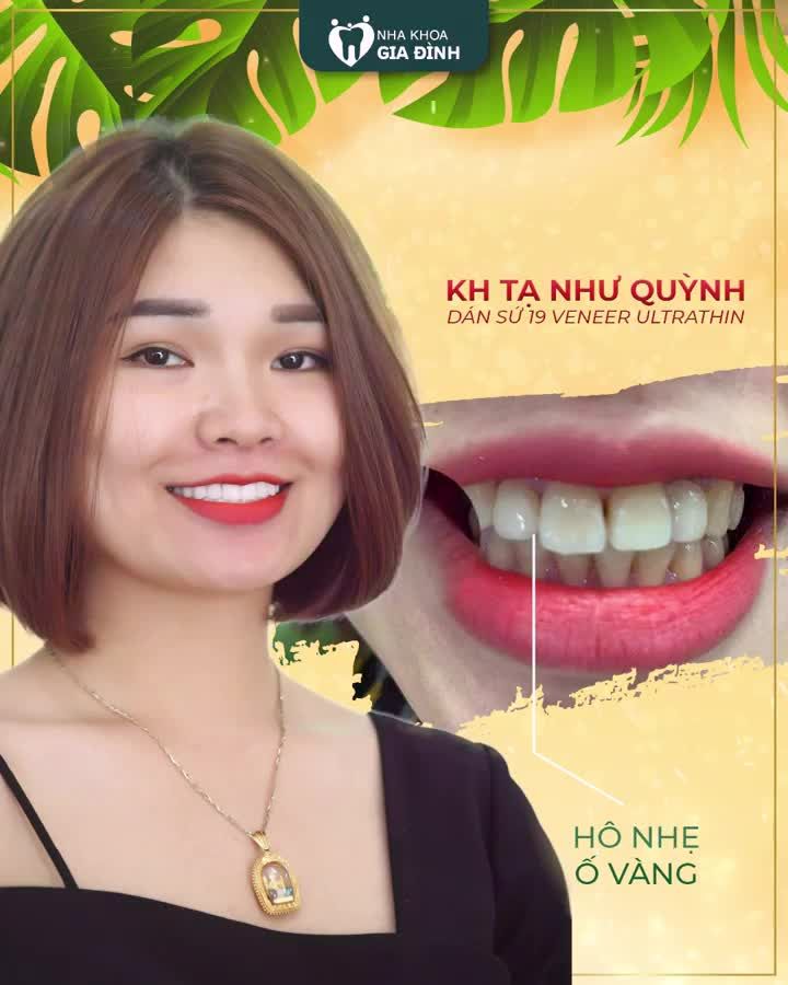 THẨM MỸ RĂNG RẠNG NGỜI KHOE SẮC THẮM
