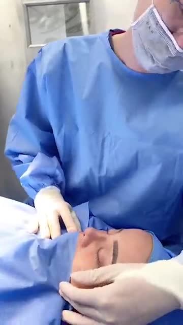 Care khách hàng Nâng mũi sụn sườn 100%