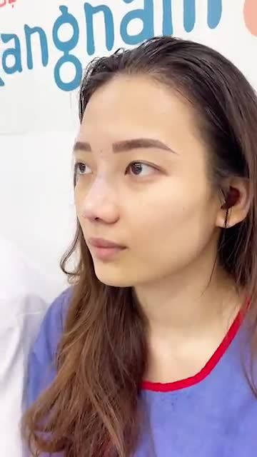 "Siêu phẩm" nâng mũi cấu trúc 4D Nanofrom của BVTM Kangnam
