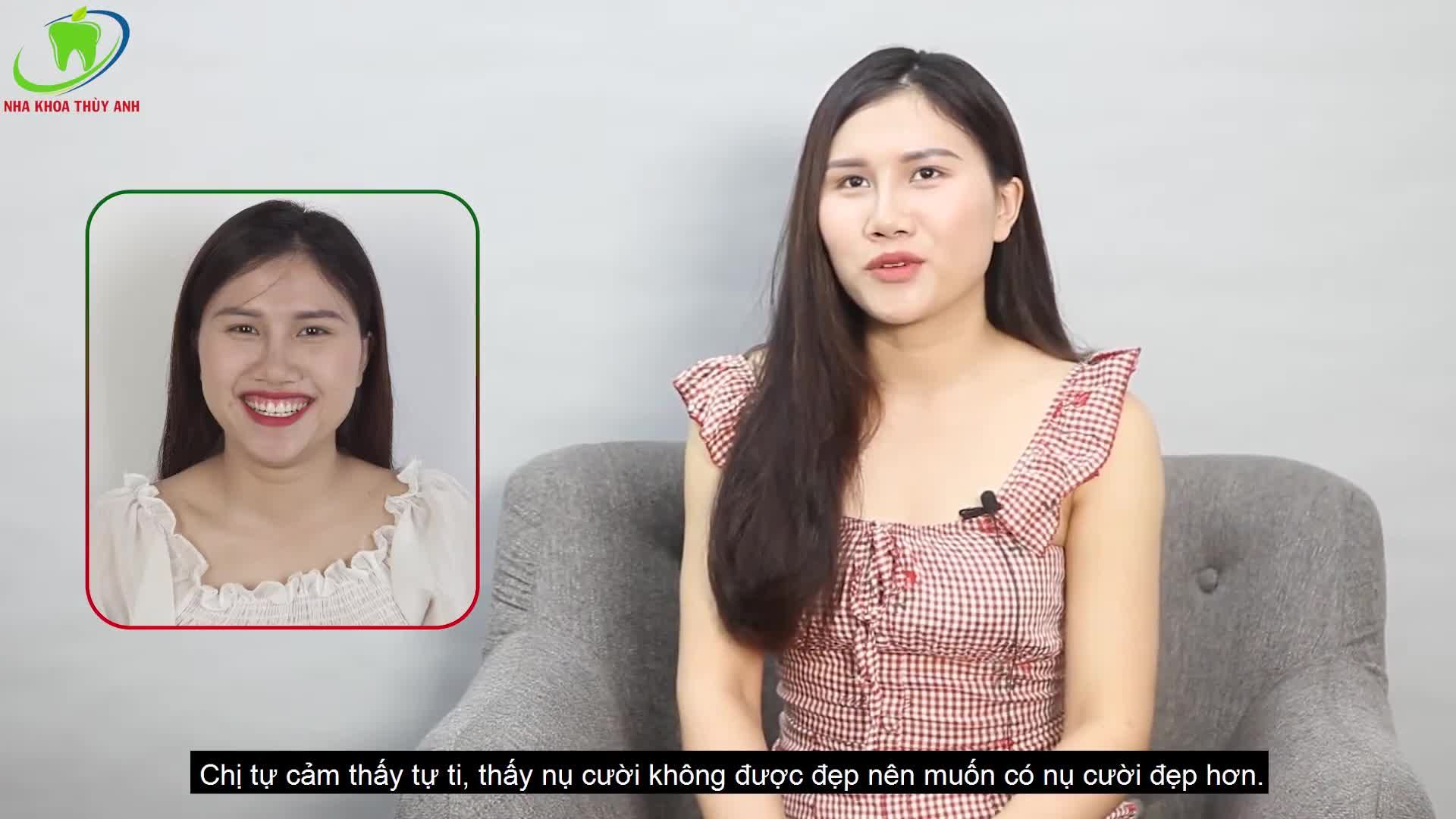 Điều trị cười hở lợi không phải là điều trị bệnh lý mà là sửa khuyến khuyết nụ cười.