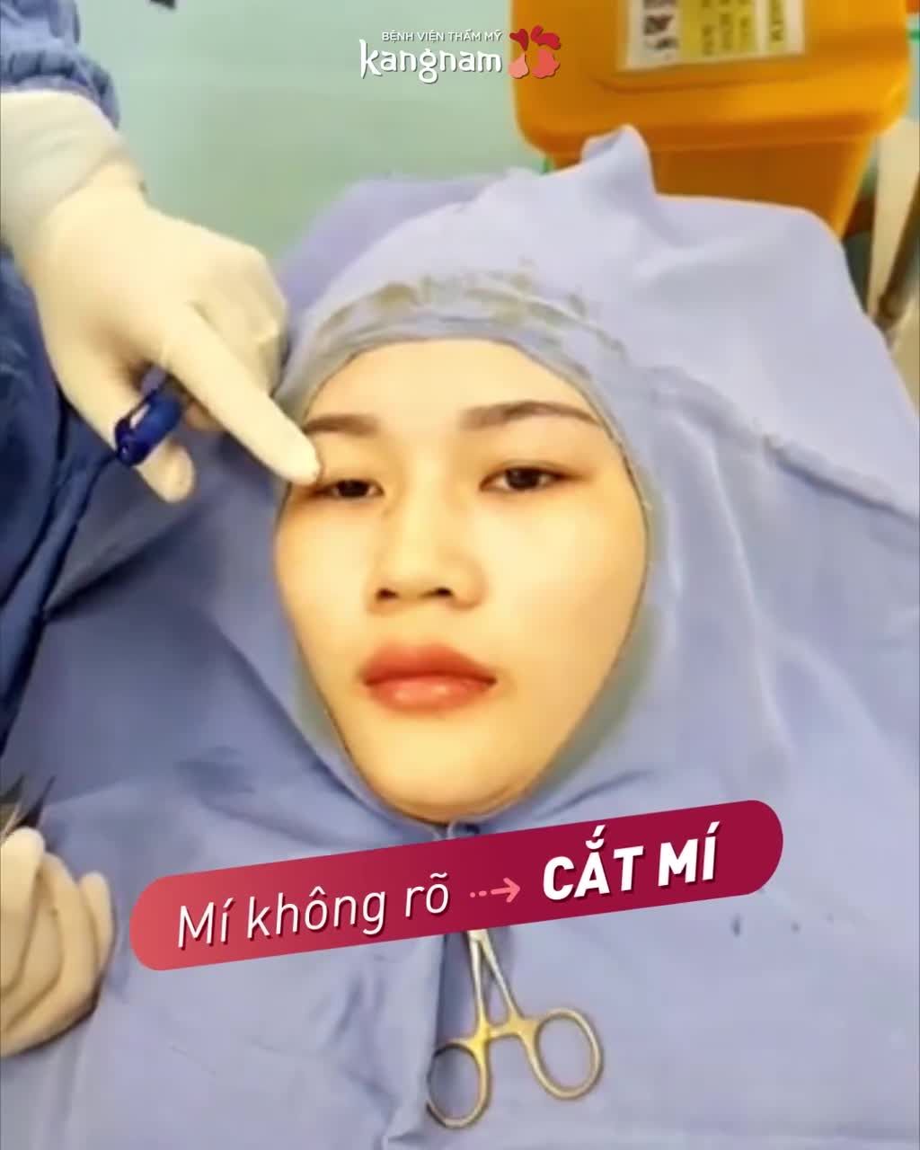 Muốn MẮT ĐẸP điểm 10  Phải chọn đúng TỶ LỆ MÍ!