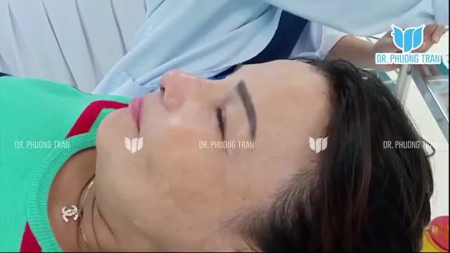 2 LẦN TRƯỚC NÂNG MŨI AI NHÌN CŨNG CHÊ GIỐNG BÊ ĐÊ