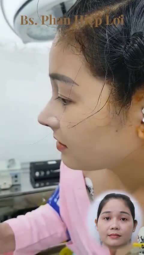QUÝ CÔ CHÀO THÁNG 7 VỚI MŨI MỚI ƯNG Ý