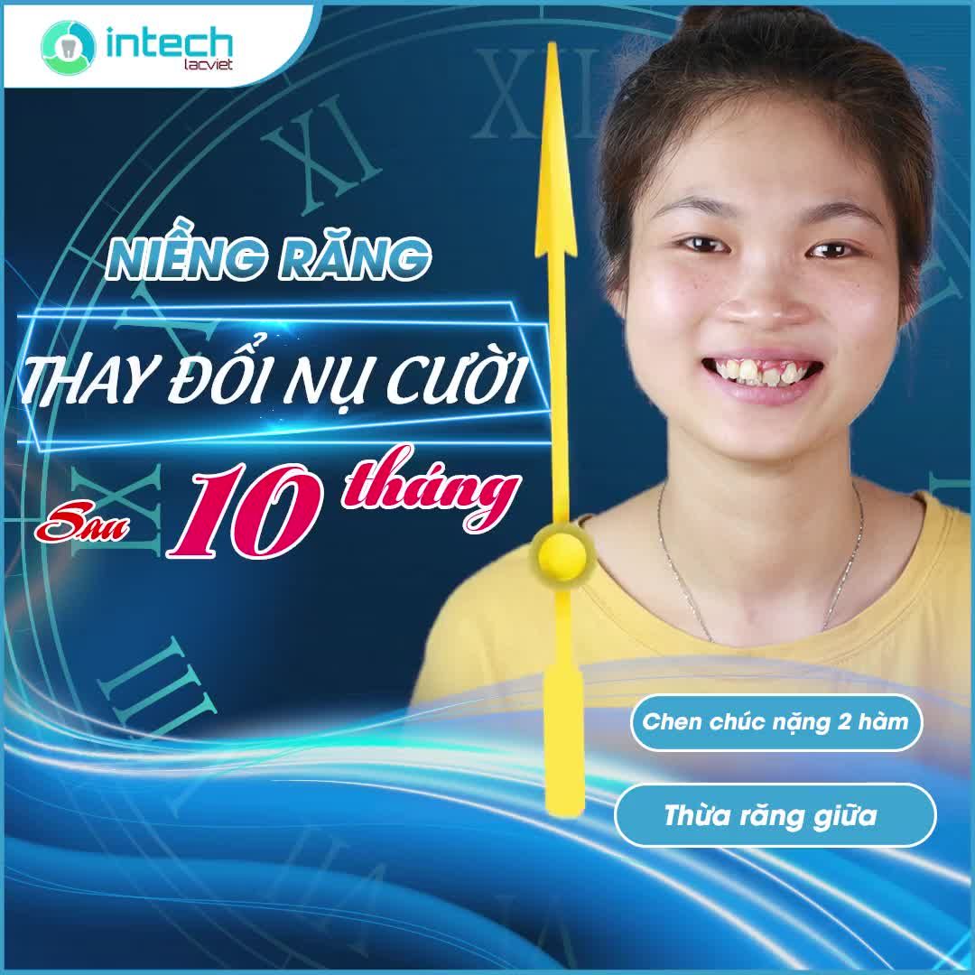 THAY ĐỔI NỤ CƯỜI - ĐIỂM MƯỜI TỰ TIN
