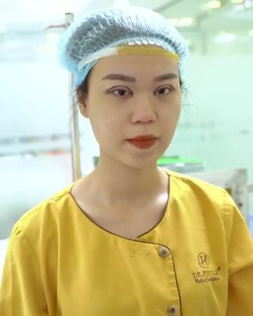 Thổi hồn vào đôi mắt, không là gì khác nếu không phải là Cắt mí kết hợp mở góc mắt. Mắt 2 mí tươi trẻ, tự nhiên, đẹp rạng ngời.