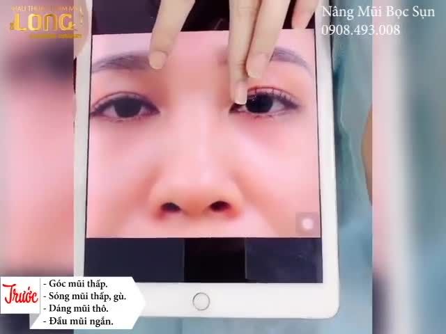 Với khuôn mặt khả ái, xinh đẹp. Khuyếm khuyết duy nhất của chị chính là chiếc mũi