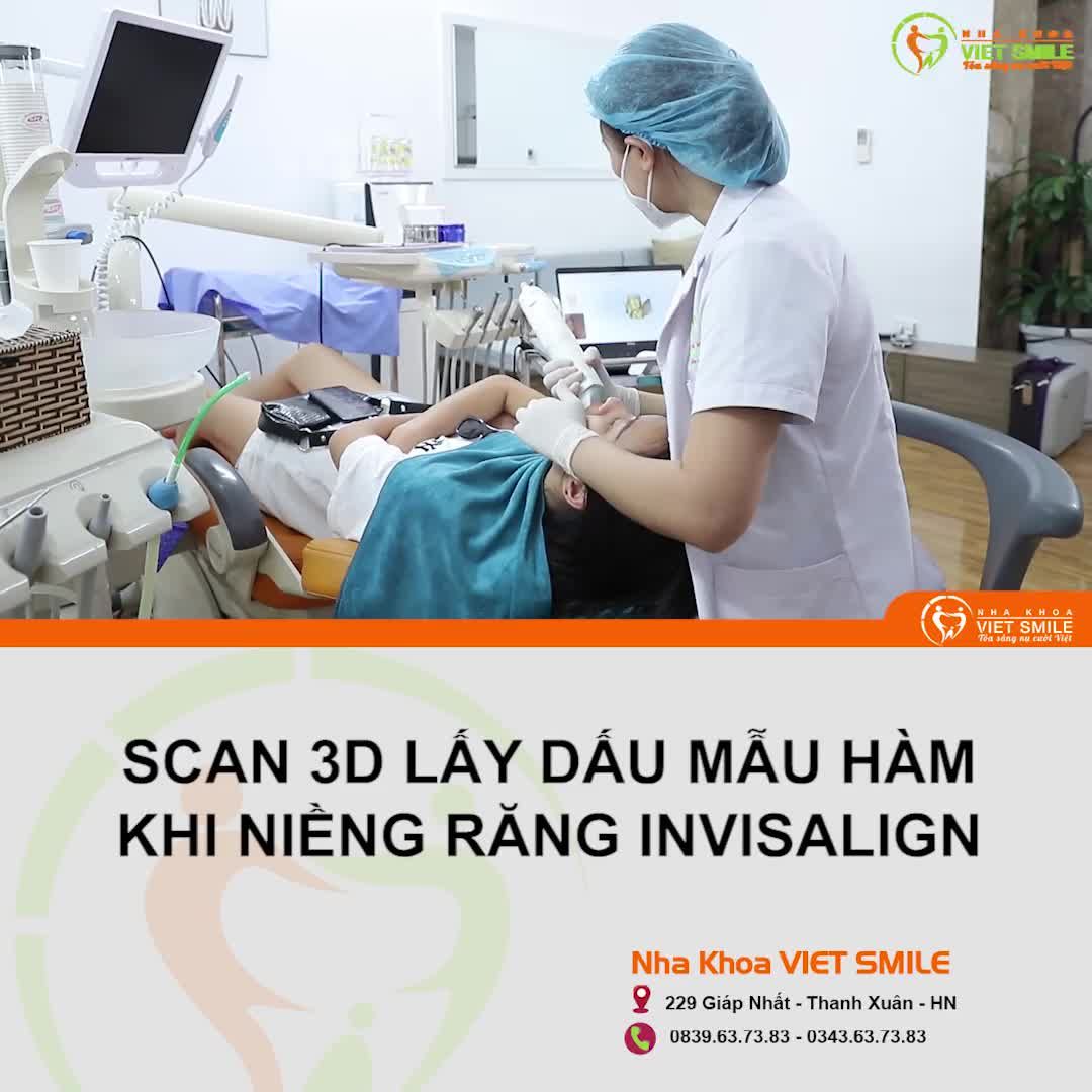 Xem trước kết quả niềng răng với Scan 3D lấy dấu hàm