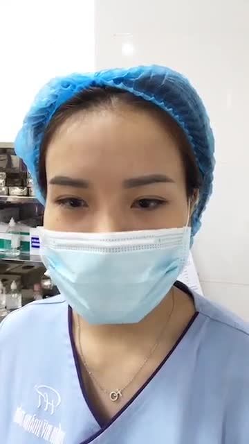 Cánh mũi tròn to, gốc mũi quá thấp ngắn sau khi nâng mũi cấu trúc Pureform của bác sĩ cải thiện như thế nào?