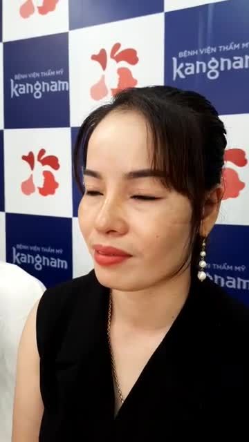 MŨI XINH XUẤT SẮC SAU 10 NGÀY NÂNG MŨI CẤU TRÚC 4D