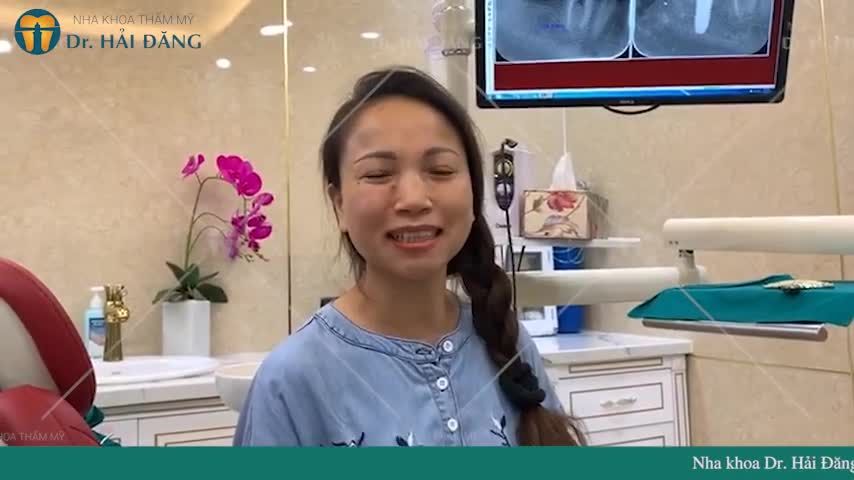 Khách hàng Thu Thủy đến với Nha khoa Dr. Hải Đăng với mong muốn thaó cầu răng R47 và thay thế bằng răng Implant.