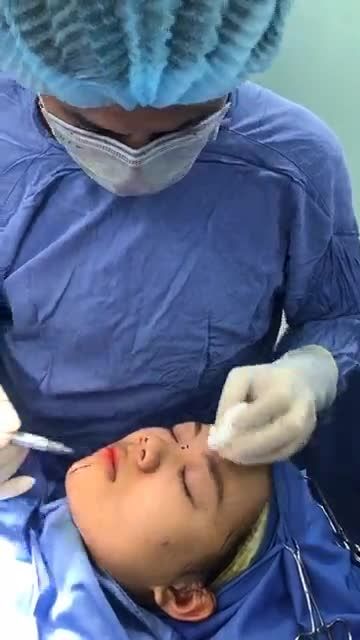 Làm sao để thay đổi dáng mũi ngắn thấp?- Cùng bác sĩ Kangnam chia sẻ công nghệ Nâng mũi cấu trúc 4D Nanoform