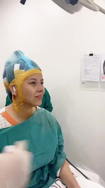 Khách hàng sóng mũi thắp, đầu mũi ngắn hếch, 2 cánh mũi to bè.