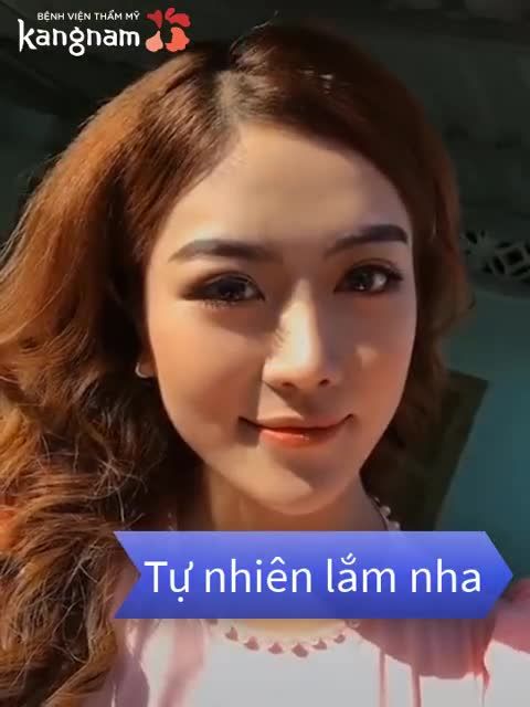 MŨI CẤU TRÚC 1 NĂM càng nhìn càng TỰ NHIÊN