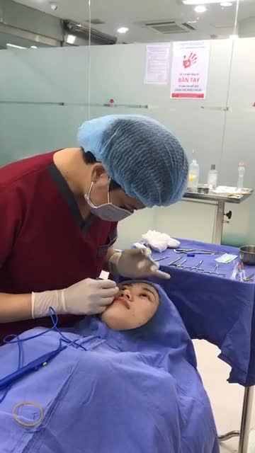 Đo vẽ quá trình cắt mí trên tại Bệnh viện Thẩm mỹ Kangnam Hà Nội