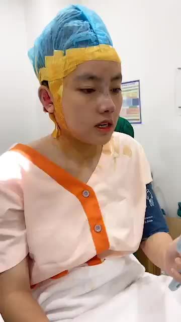 Khách hàng sóng mũi thấp và gồ nhẹ, đầu mũi ngắn, cánh mũi bè