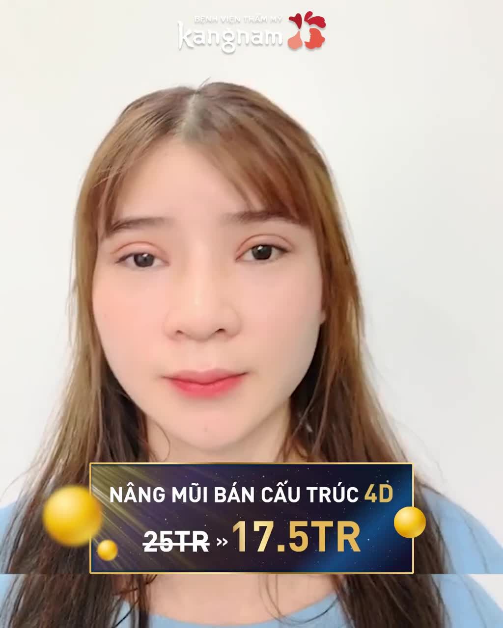 NÂNG MŨI TUẦN VÀNG - chỉ từ 12.5 Triệu