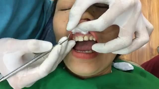 ĐÂY LÀ VIDEO THỰC TẾ - KHÔNG PHẢI QUẢNG CÁO.