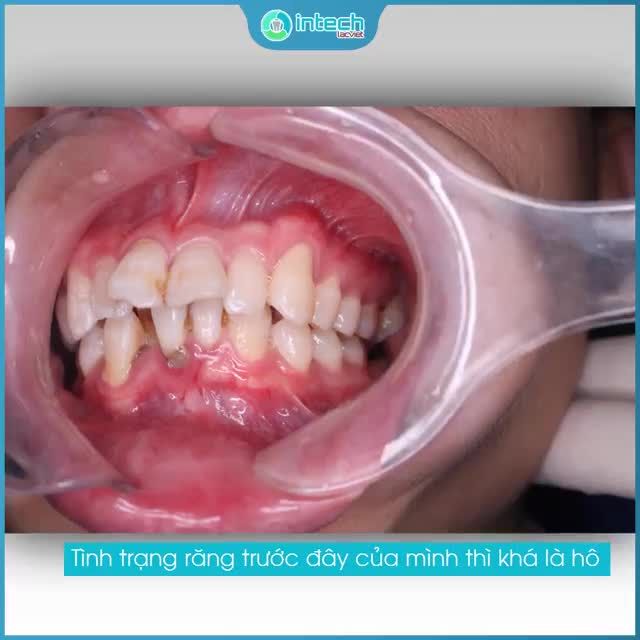 PHÁI MẠNH CŨNG CẦN NỤ CƯỜI RẠNG RỠ