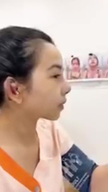 XINH ĐẸP NGAY SAU THAY ĐỔI DÁNG MŨI TO - NGẮN HẾCH NGUYÊN BẢN