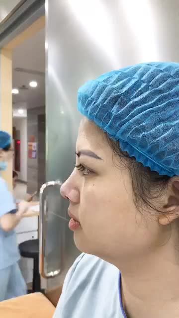 Mời cả nhà cùng theo dõi kết quả ca một ca nâng mũi cấu trúc Pureform - ca mũi số 128/7 của bác sĩ nhé!