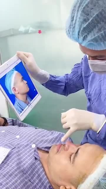 Case nâng mũi cấu trúc 4D cho khách hàng nam