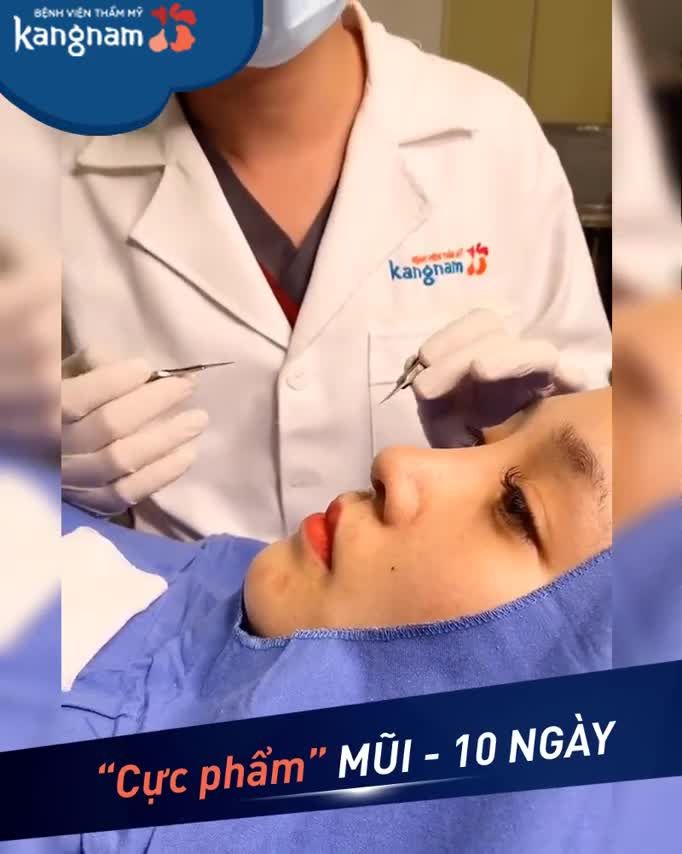 DÁNG MŨI ngày thứ 10 - "siêu phẩm" đây - nằm đã mê rồi ạ!