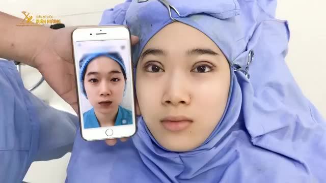 QUYẾT KHÔNG ĐỂ MÍ MẮT "DÌM HÀNG" CẢ GƯƠNG MẶT NỮ KHÁCH HÀNG CHỌN NGAY CẮT MÍ TẠI TMV XUÂN HƯƠNG