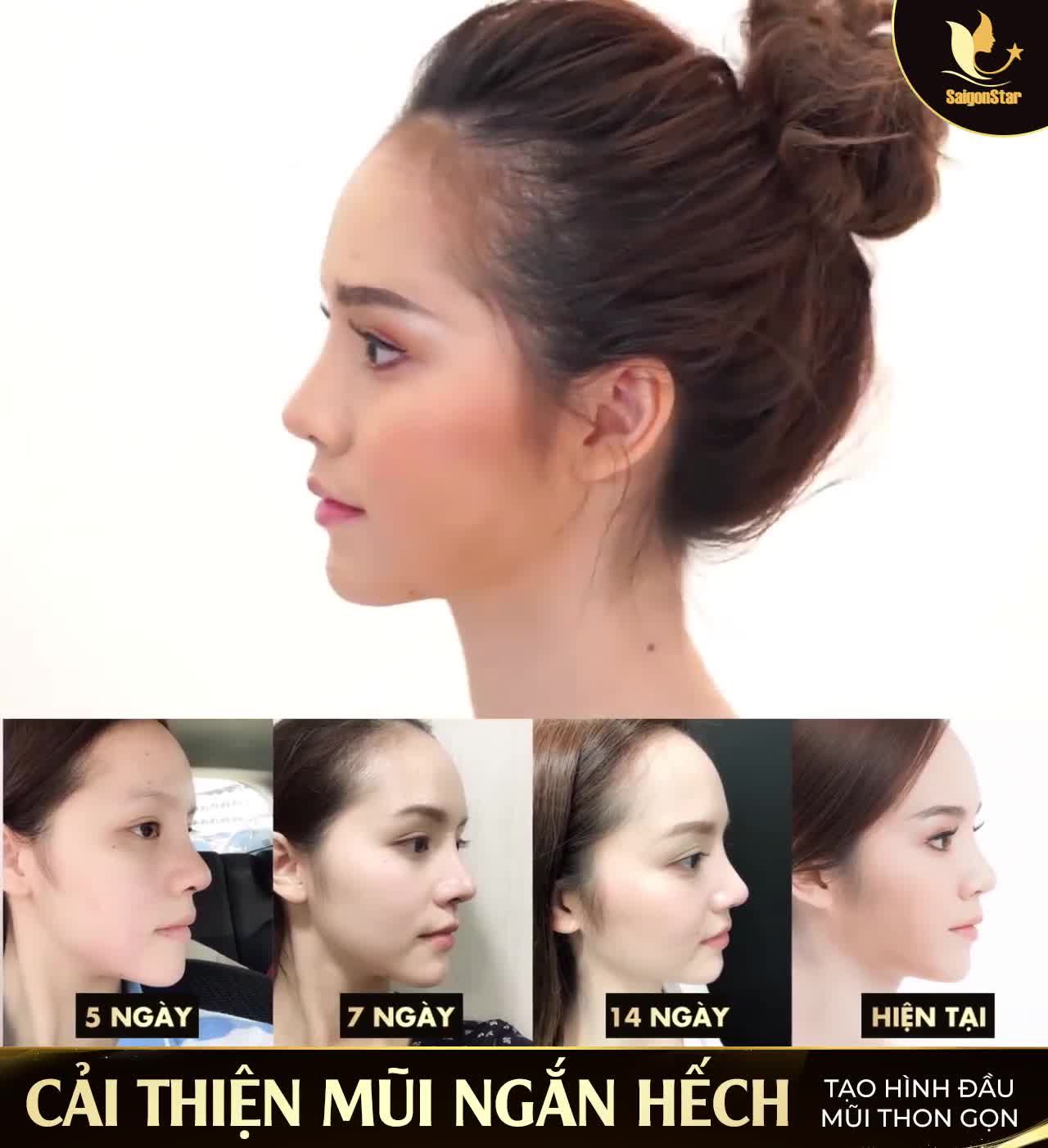 CHÀO ANH, EM ĐỨNG ĐÂY TỪ SÁNG...Chỉ để khoe Dáng Mũi Cấu Trúc thôi