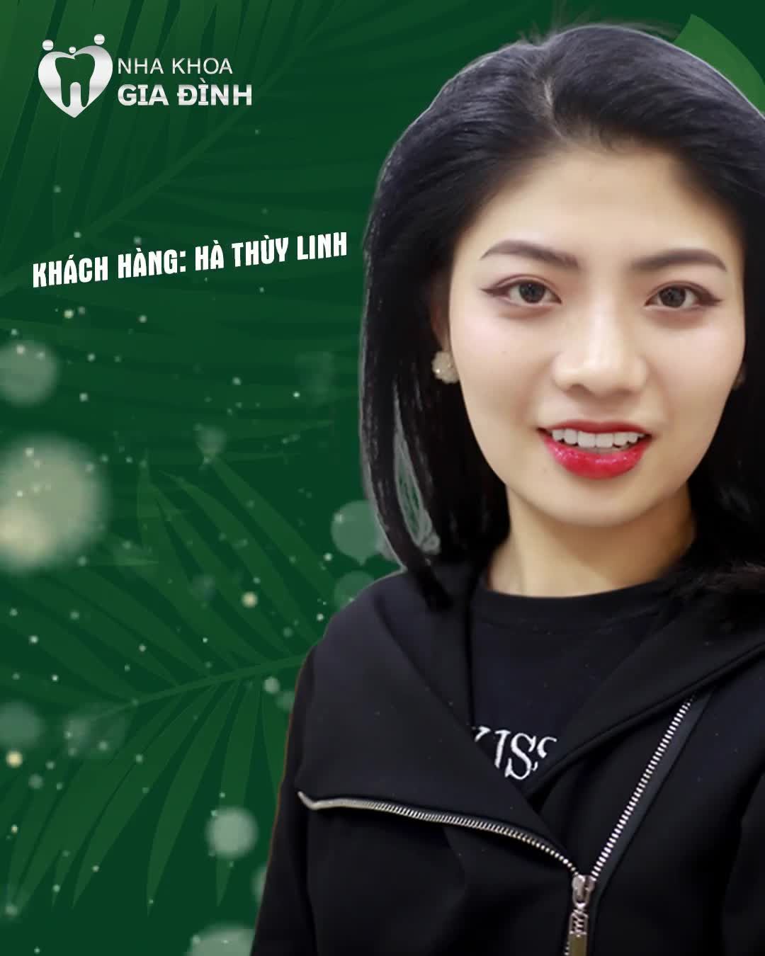 LÀM RĂNG SỨ THẨM MỸ CÓ ĐAU KHÔNG?