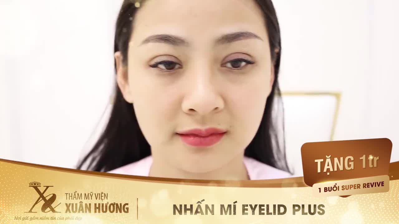 MẮT 2 MÍ ĐẸP TỰ NHIÊN NGAY SAU KHI LÀM