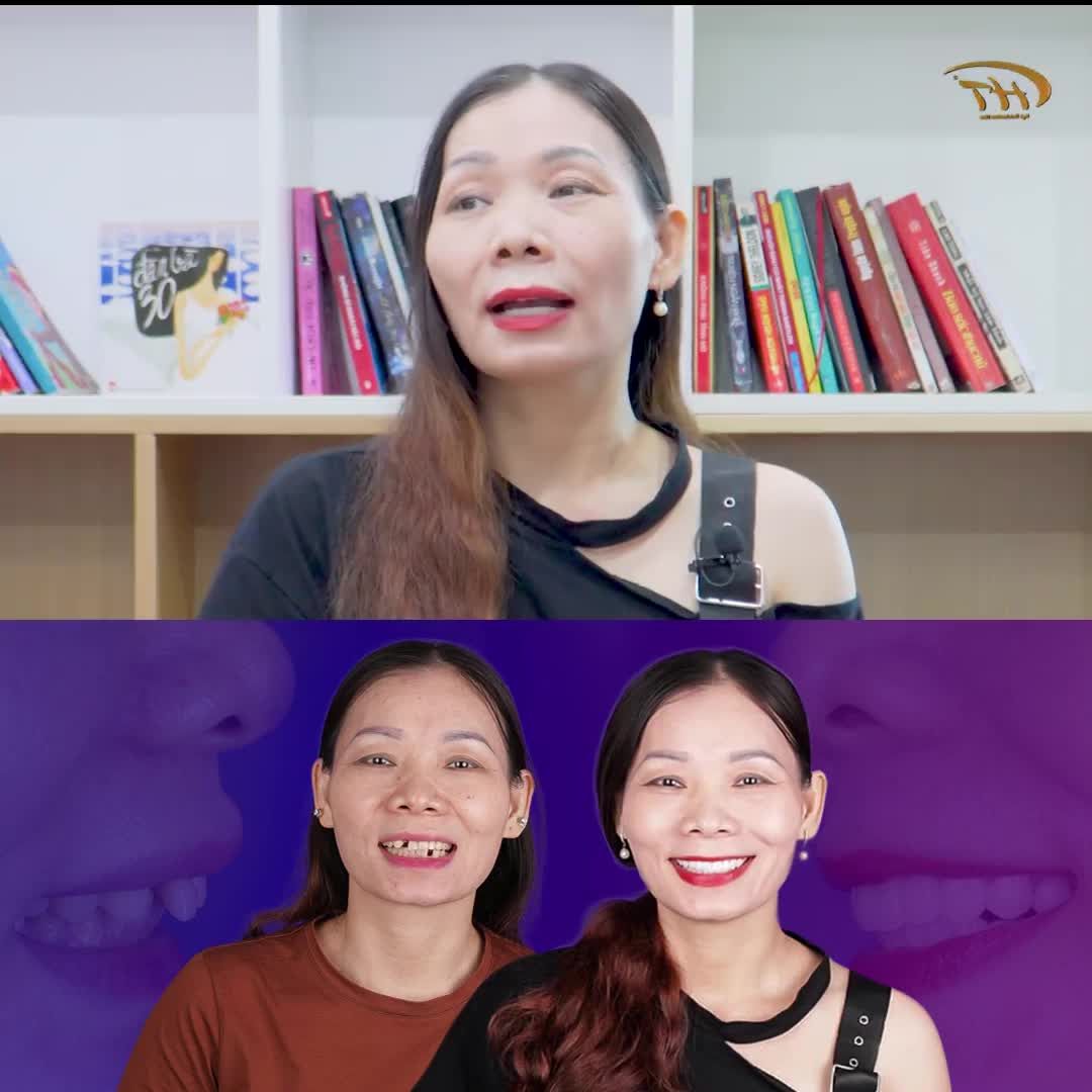 "Chị rất hay cười mà lại không dám cười 1 cách thoải mái vì răng thưa mẻ mất răng... giờ thì chị thoải mái cười rồi...hihi"