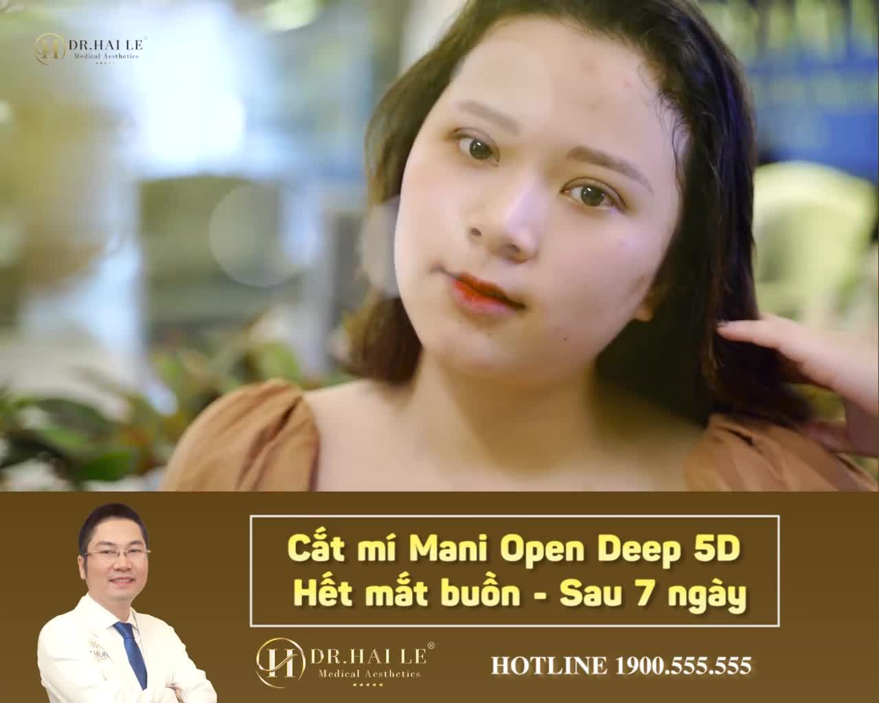 THEO DÕI DR.HẢI LÊ HƠN 2 NĂM - QUYẾT ĐỊNH CẮT MÍ MANI OPEN DEEP 5D TRONG PHÚT CHỐC VÀ KẾT QUẢ... ‼️