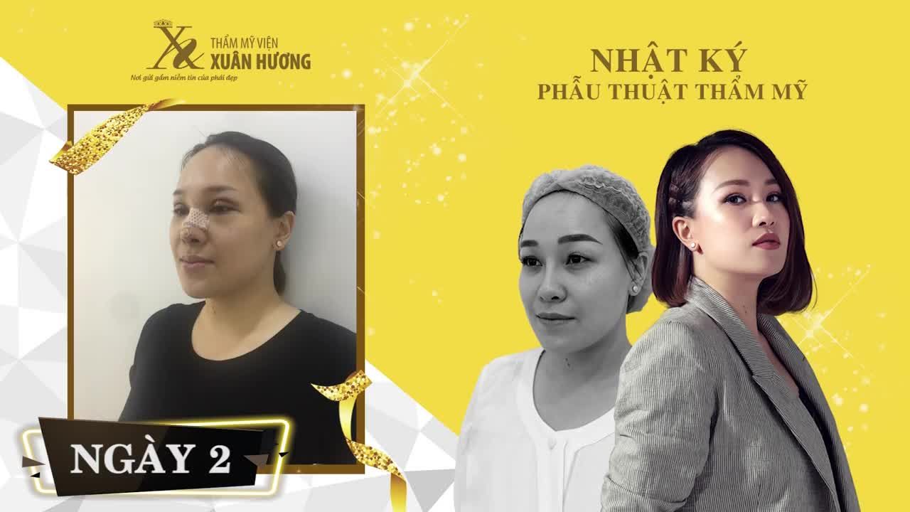 20 NGÀY THAY ĐỔI NHAN SẮC BẤT NGỜ CỦA Á QUÂN THE VOICE 2018 - NGUYỄN MINH NGỌC