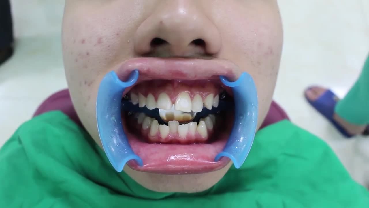 Bạn đã thực sự quan tâm đến hàm răng của mình đúng cách và thường xuyên?
