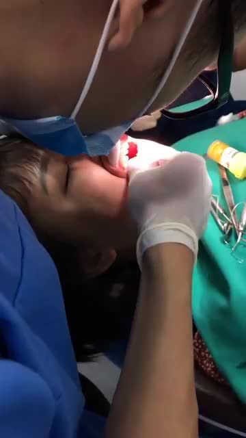 Cận cảnh ca gắn 20 răng sứ cuối ngày tại Nha khoa Shinbi