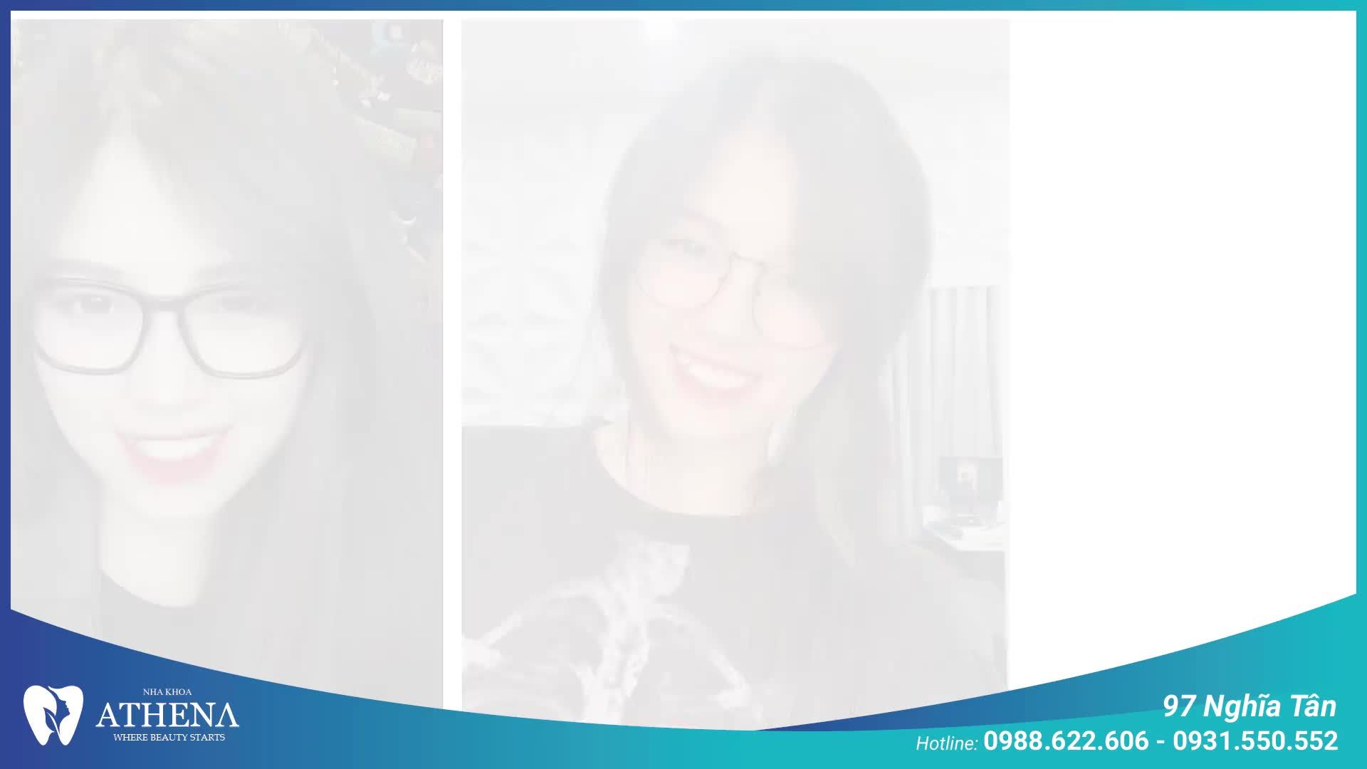 Cùng nghe chia sẻ về niềng răng trong suốt Invisalign của bạn Thủy Tiên để hiểu rõ hơn về suy nghĩ và cảm nhận của bạn khi niềng răng tại Nha khoa Quốc tế Athena nhé!