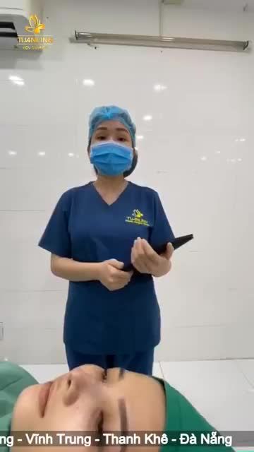 Nâng mũi cấu trúc sụn Surgiform tại VTM Tuấn Linh đầu giờ chiều nè các bạn ơi !