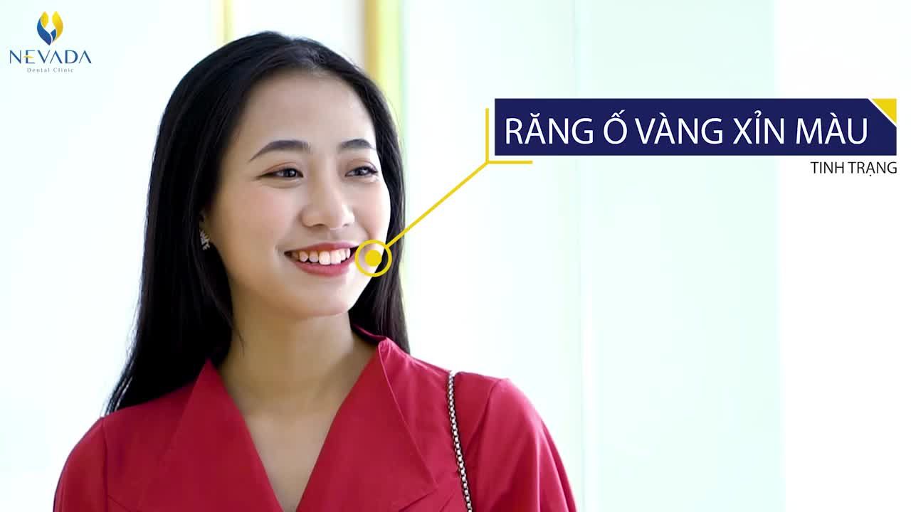 RĂNG XINH TRẮNG SÁNG - XỨNG ĐÁNG ĐẦU TƯ