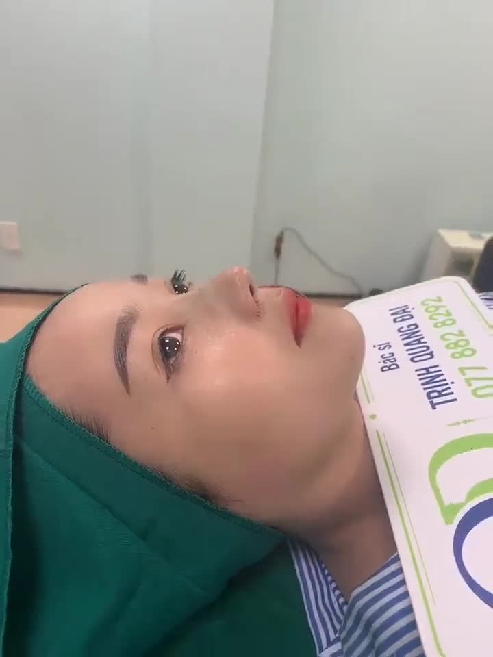 SIÊU PHẨM MŨI BÁN CẤU TRÚC LÓT MEGADERM ĐẸP XUẤT SẮC!