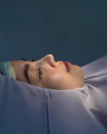 "Siêu phẩm" NÂNG MŨI DEMI 5D tự tin khoe GÓC NGHIÊNG HOÀN HẢO!