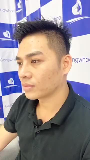 TÁI KHÁM COMBO NÂNG MŨI CẤU TRÚC + GOM CÁNH MŨI ĐẸP HOÀN HẢO