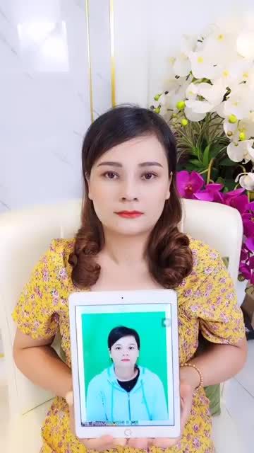 Tái khám mũi 10 ngày cắt chỉ